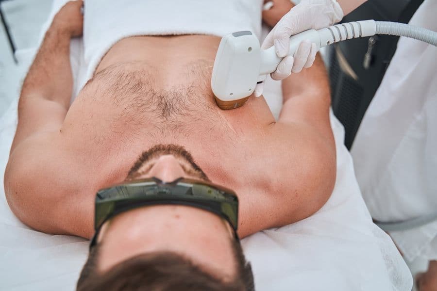 Epilare definitivă pachet Full-Body Bărbați